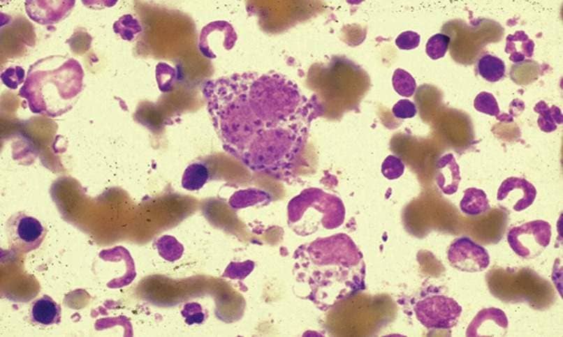 parasito leishmania visto a traves de microscopio